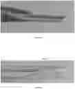 Fig. 29 - Systems, devices, and methods for analyte sensor insertion