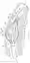 Fig. 13 - METHODS AND APPARATUS FOR RENAL NEUROMODULATION