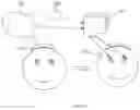 Fig. 03 - Cranial implant