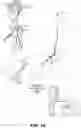 Fig. 02 - ENDOVASCULAR ELECTROENCEPHALOGRAPHY (EEG) AND ELECTROCORTICOGRAPHY (ECoG) DEVICES, SYSTEMS AND METHODS