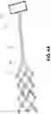 Fig. 06 - ENDOVASCULAR ELECTROENCEPHALOGRAPHY (EEG) AND ELECTROCORTICOGRAPHY (ECoG) DEVICES, SYSTEMS AND METHODS
