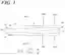 Fig. 04 - X-ray fluoroscopic imaging apparatus