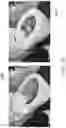 Fig. 11 - SYSTEMS AND METHODS FOR PROCESSING STOOL SAMPLES