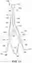 Fig. 13 - MEDICAL DEVICE FOR CLOSURE OF A VASCULAR ABNORMALITY