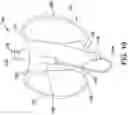 Fig. 18 - MEDICAL DEVICE FOR CLOSURE OF A VASCULAR ABNORMALITY