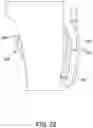 Fig. 22 - MEDICAL DEVICE FOR CLOSURE OF A VASCULAR ABNORMALITY
