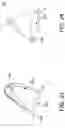 Fig. 23 - MEDICAL DEVICE FOR CLOSURE OF A VASCULAR ABNORMALITY