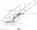 Fig. 03 - Vessel Sealing Device