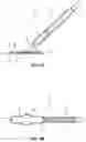 Fig. 04 - Vessel Sealing Device