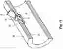 Fig. 13 - Vessel Sealing Device