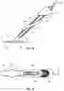 Fig. 21 - Vessel Sealing Device