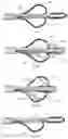 Fig. 06 - SYSTEMS AND METHODS FOR ORGAN RETRACTION AND SPACE OPENING