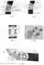 Fig. 08 - SYSTEMS AND METHODS FOR ORGAN RETRACTION AND SPACE OPENING