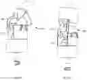Fig. 10 - SYSTEMS AND METHODS FOR ORGAN RETRACTION AND SPACE OPENING