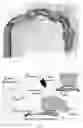 Fig. 11 - SYSTEMS AND METHODS FOR ORGAN RETRACTION AND SPACE OPENING