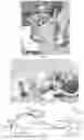 Fig. 12 - SYSTEMS AND METHODS FOR ORGAN RETRACTION AND SPACE OPENING