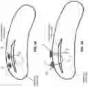 Fig. 51 - METHOD AND APPARATUS FOR CLOSING A FISSURE IN THE ANNULUS OF AN INTERVERTEBRAL DISC, AND/OR FOR EFFECTING OTHER ANATOMICAL REPAIRS AND/OR FIXATIONS