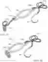 Fig. 08 - Dynamic tensioning devices for orthopedic compression