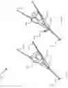 Fig. 15 - Suture based clamping device