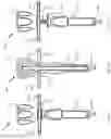 Fig. 20 - Suture based clamping device