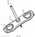 Fig. 25 - Suture based clamping device