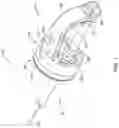 Fig. 02 - Endoscope attachment mechanism for use with suture based closure device