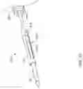 Fig. 17 - Endoscope attachment mechanism for use with suture based closure device