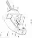 Fig. 24 - Endoscope attachment mechanism for use with suture based closure device