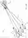 Fig. 22 - DEVICES FOR CARDIAC SURGERY AND METHODS THEREOF
