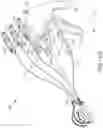 Fig. 30 - DEVICES FOR CARDIAC SURGERY AND METHODS THEREOF