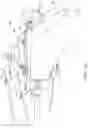Fig. 32 - DEVICES FOR CARDIAC SURGERY AND METHODS THEREOF