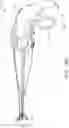 Fig. 42 - DEVICES FOR CARDIAC SURGERY AND METHODS THEREOF