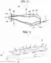 Fig. 03 - One-way adjustable loop suture constructs and methods of forming and using the same