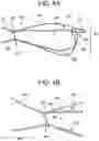 Fig. 04 - One-way adjustable loop suture constructs and methods of forming and using the same