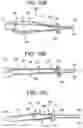 Fig. 10 - One-way adjustable loop suture constructs and methods of forming and using the same
