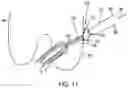 Fig. 11 - One-way adjustable loop suture constructs and methods of forming and using the same