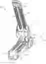 Fig. 01 - Surgical stapler buttress assembly with adhesion to wet end effector
