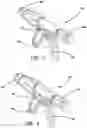 Fig. 04 - Surgical stapler having articulation mechanism