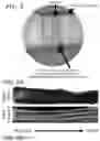 Fig. 06 - Biomimetic Scaffold for Peripheral Nerve Injuries