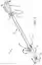 Fig. 02 - Left atrial appendage treatment systems and methods