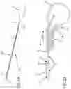 Fig. 03 - Left atrial appendage treatment systems and methods