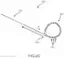 Fig. 04 - Left atrial appendage treatment systems and methods