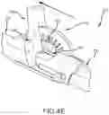 Fig. 12 - Left atrial appendage treatment systems and methods