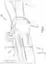 Fig. 15 - Left atrial appendage treatment systems and methods