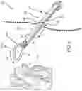 Fig. 16 - Left atrial appendage treatment systems and methods