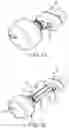 Fig. 17 - Left atrial appendage treatment systems and methods