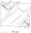 Fig. 25 - Left atrial appendage treatment systems and methods