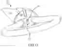 Fig. 29 - Left atrial appendage treatment systems and methods