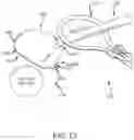 Fig. 30 - Left atrial appendage treatment systems and methods