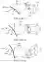 Fig. 31 - Left atrial appendage treatment systems and methods